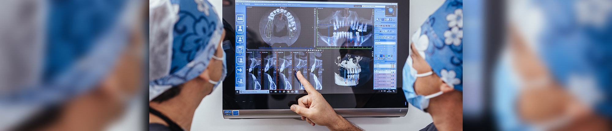 Pose d'implants dentaires à Marseille - CIPE Marseille